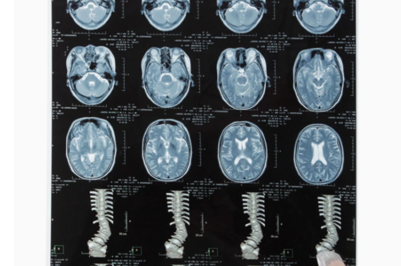 Dry Imaging X Ray Films