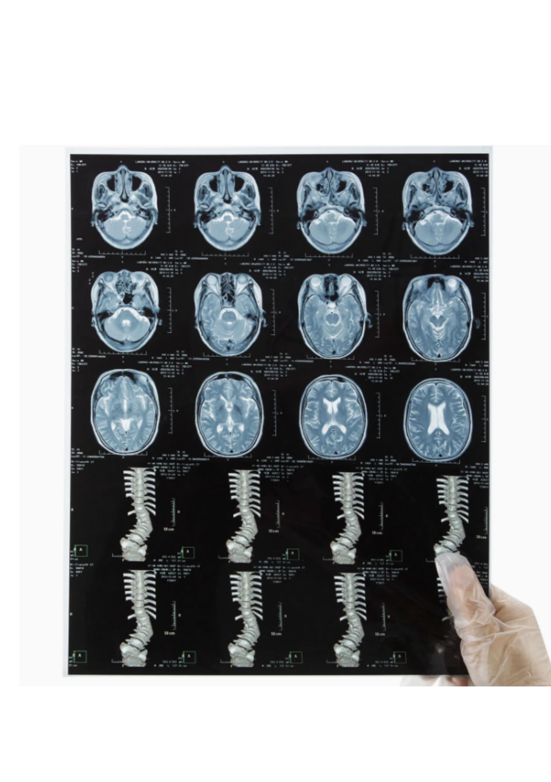 Dry Imaging X Ray Films