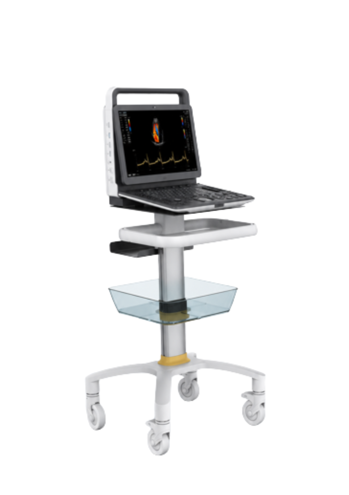 M30 Portable ultrasound