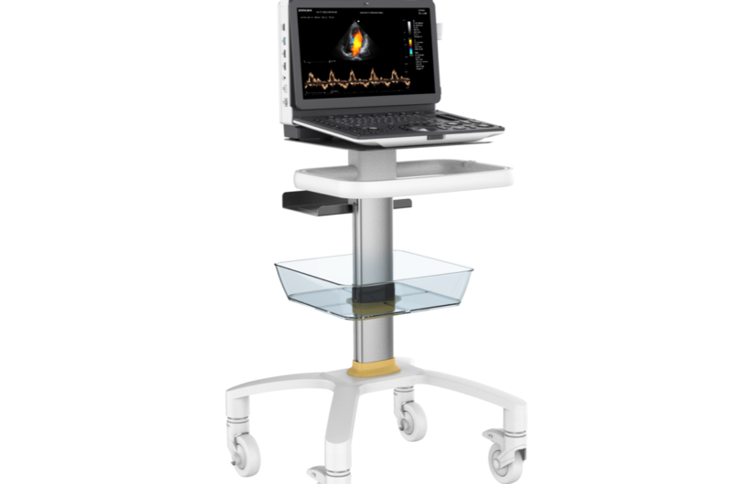 M70 Portable ultrasound
