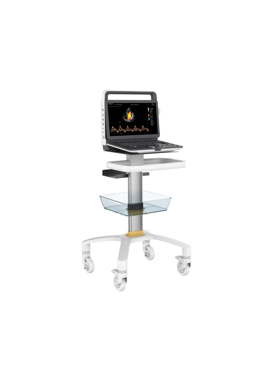M70 Portable ultrasound
