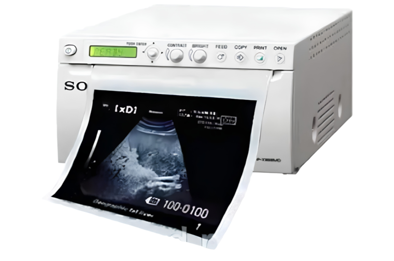 ULTRASOUND PRINTER
