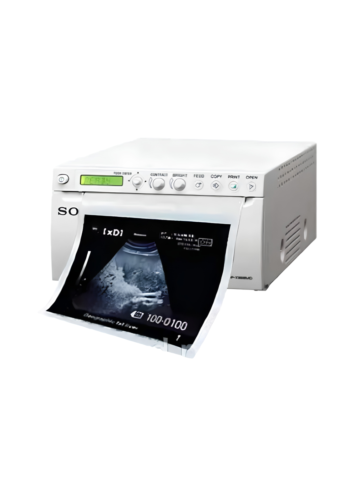 ULTRASOUND PRINTER